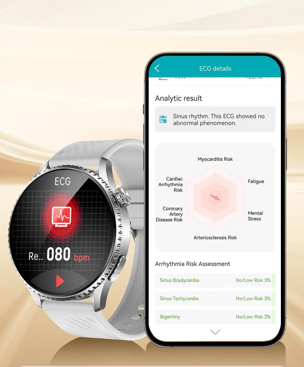 ST30心电图监测功能